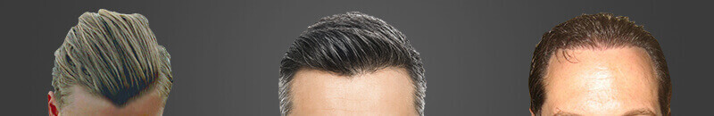 HairLine Of Your Desire Style & Look - iGraft