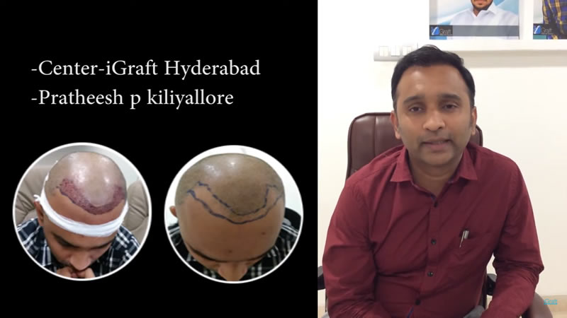 iGraft Hyderabad Reviews by Mr Pratheesh