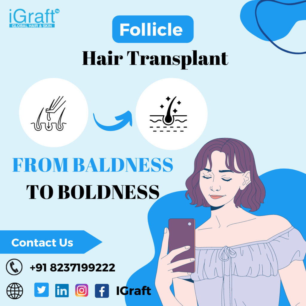 nano follicle hair transplant