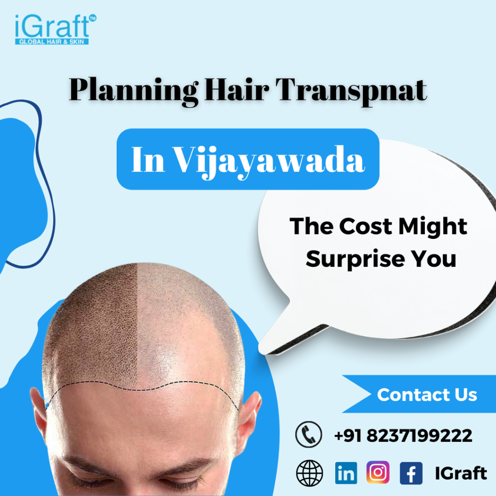 Hair Transplant in Vijayawada