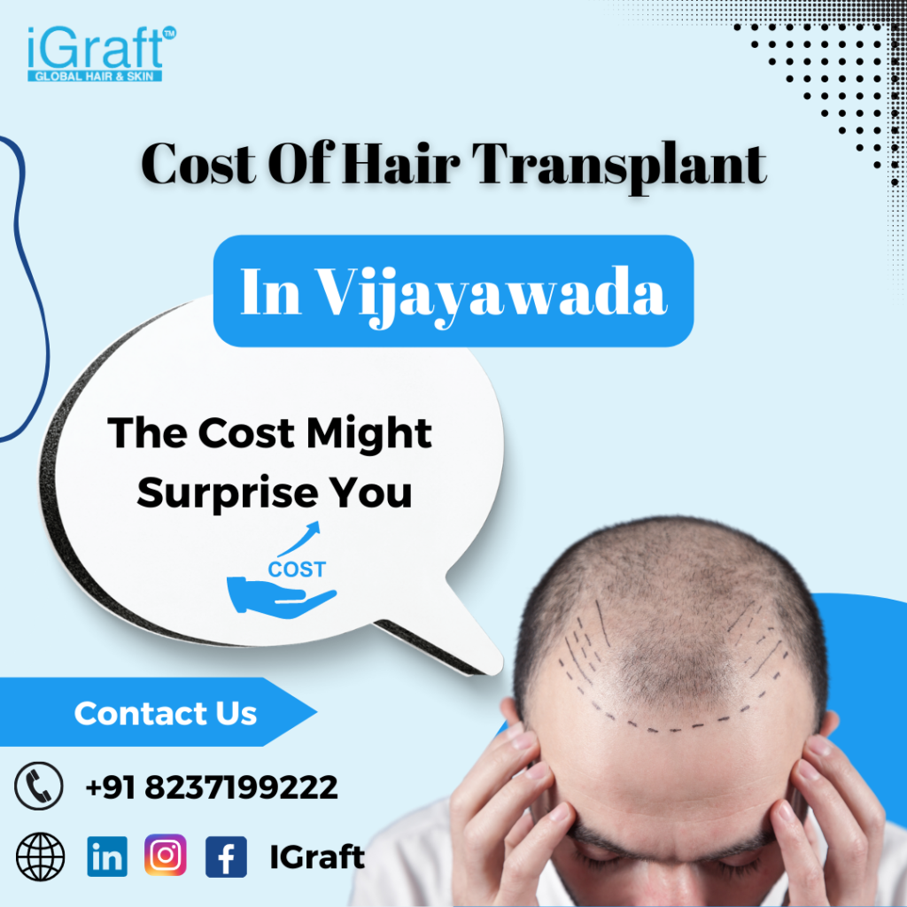 Hair Transplant cost
