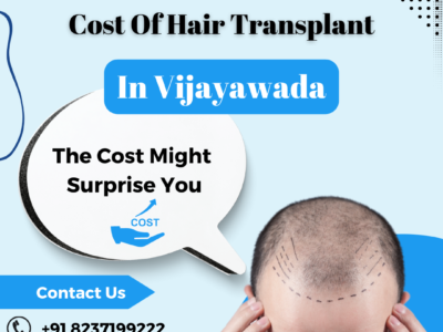 Hair Transplant cost