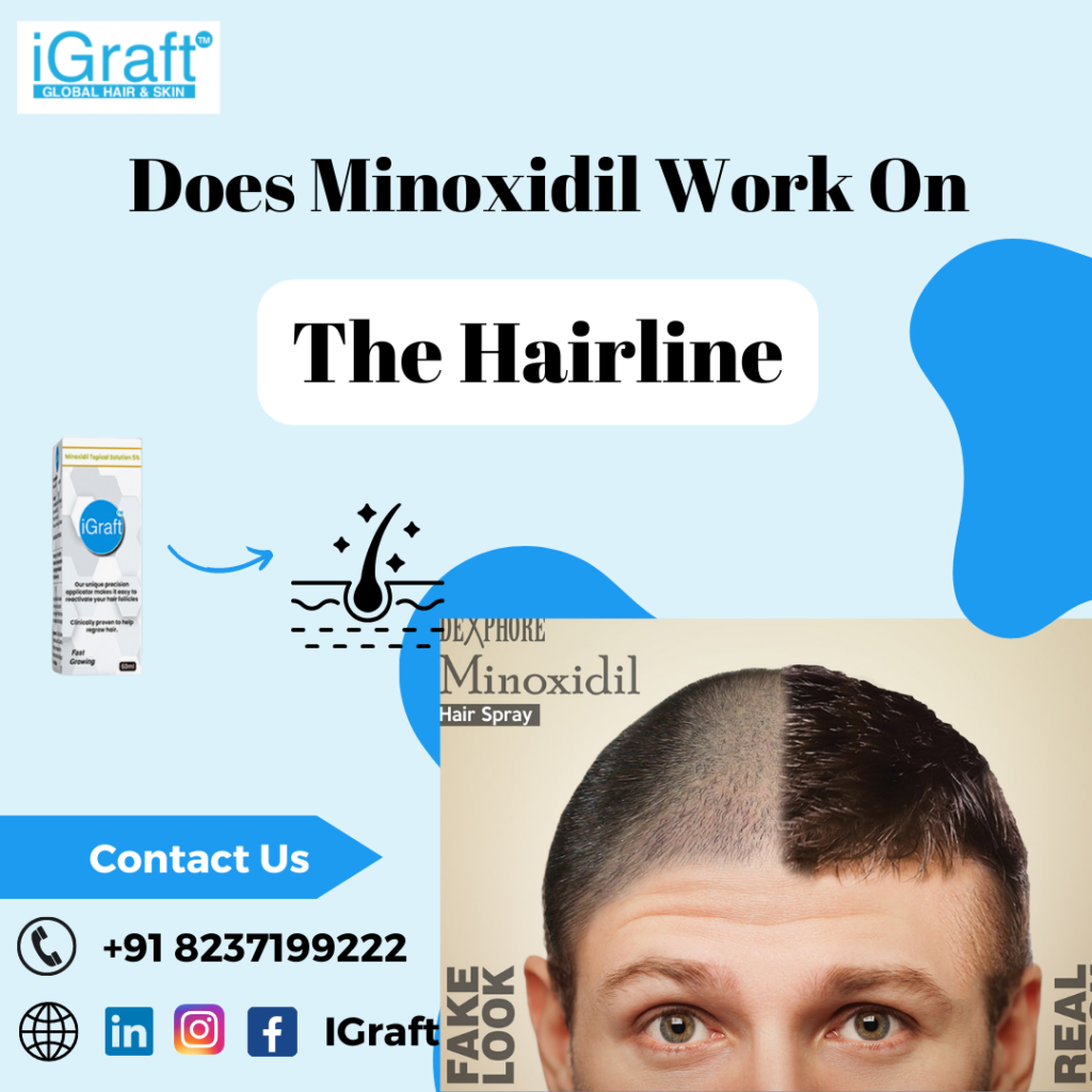 Minoxidil