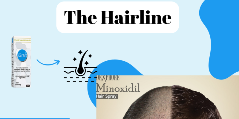 Minoxidil