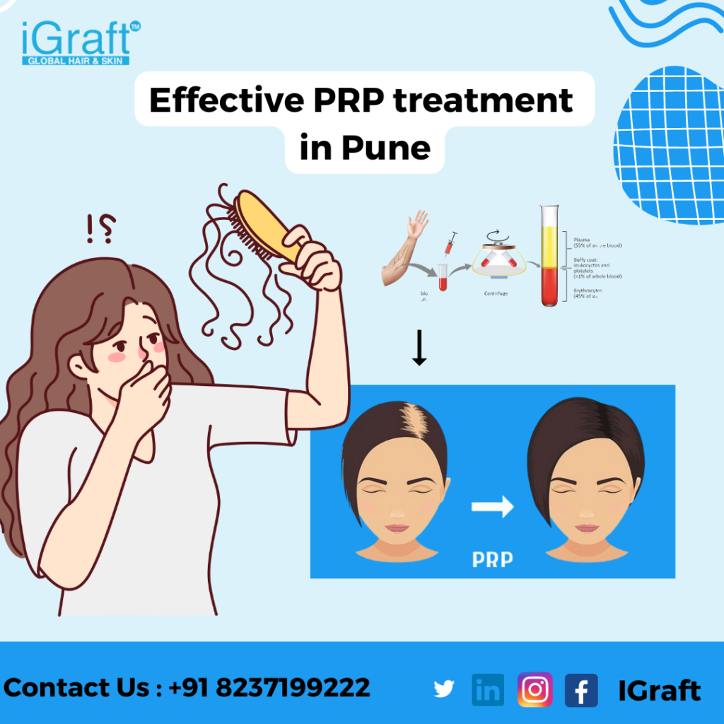 effective PRP treatment
