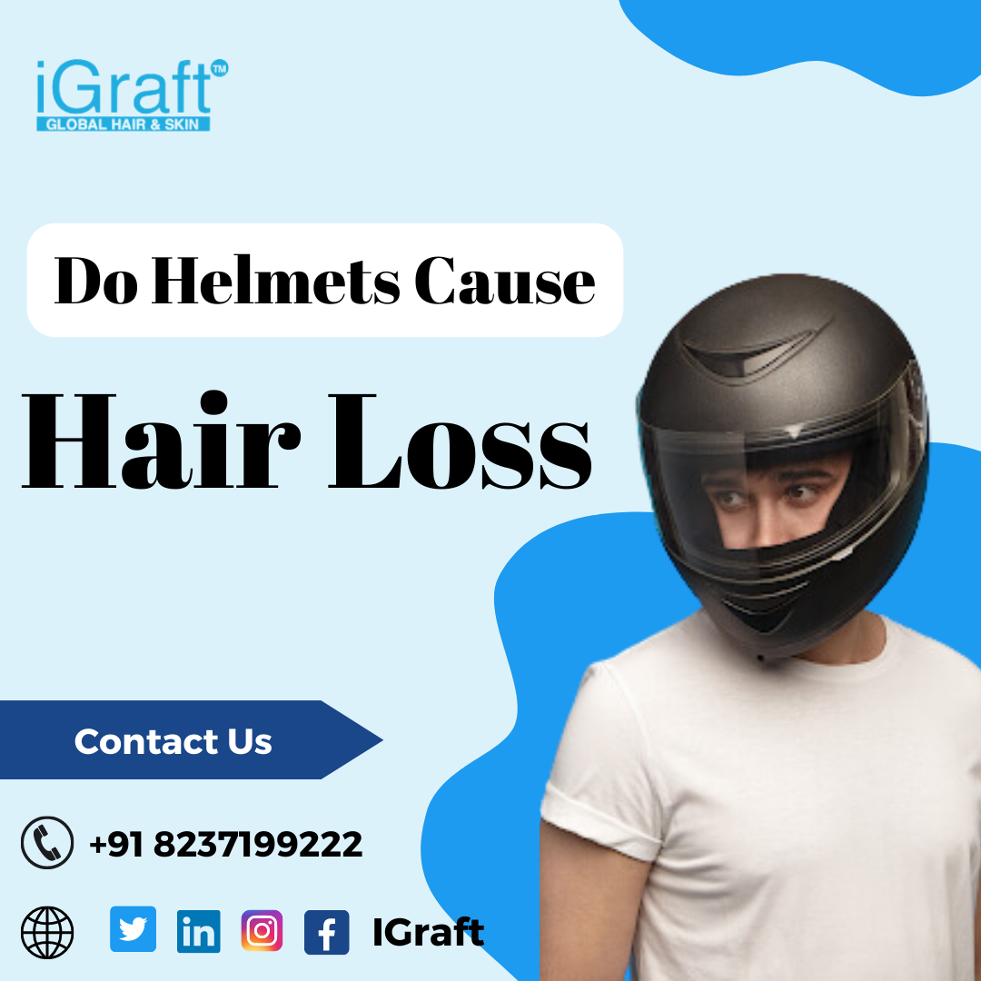 do Helmet causes hair loss