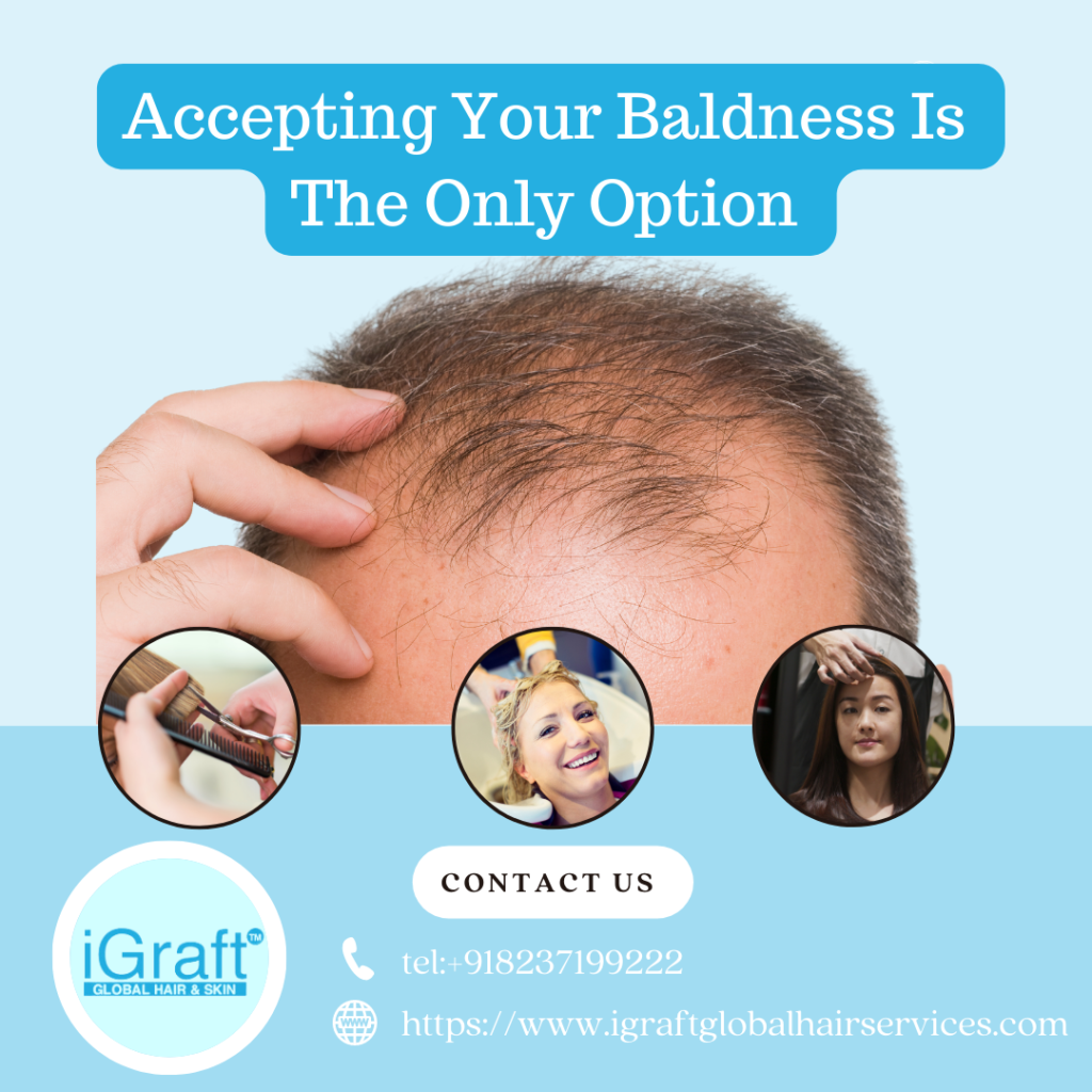 Baldness
