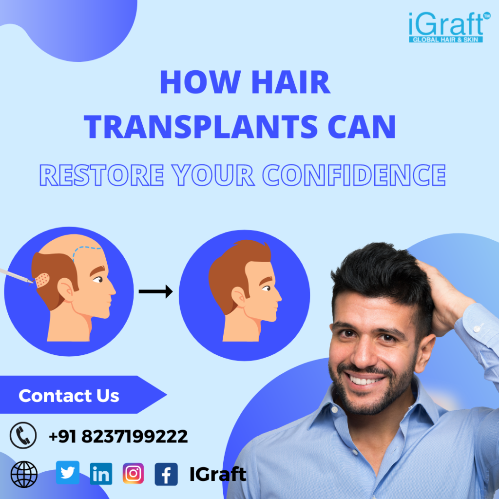 iGraft Pune
