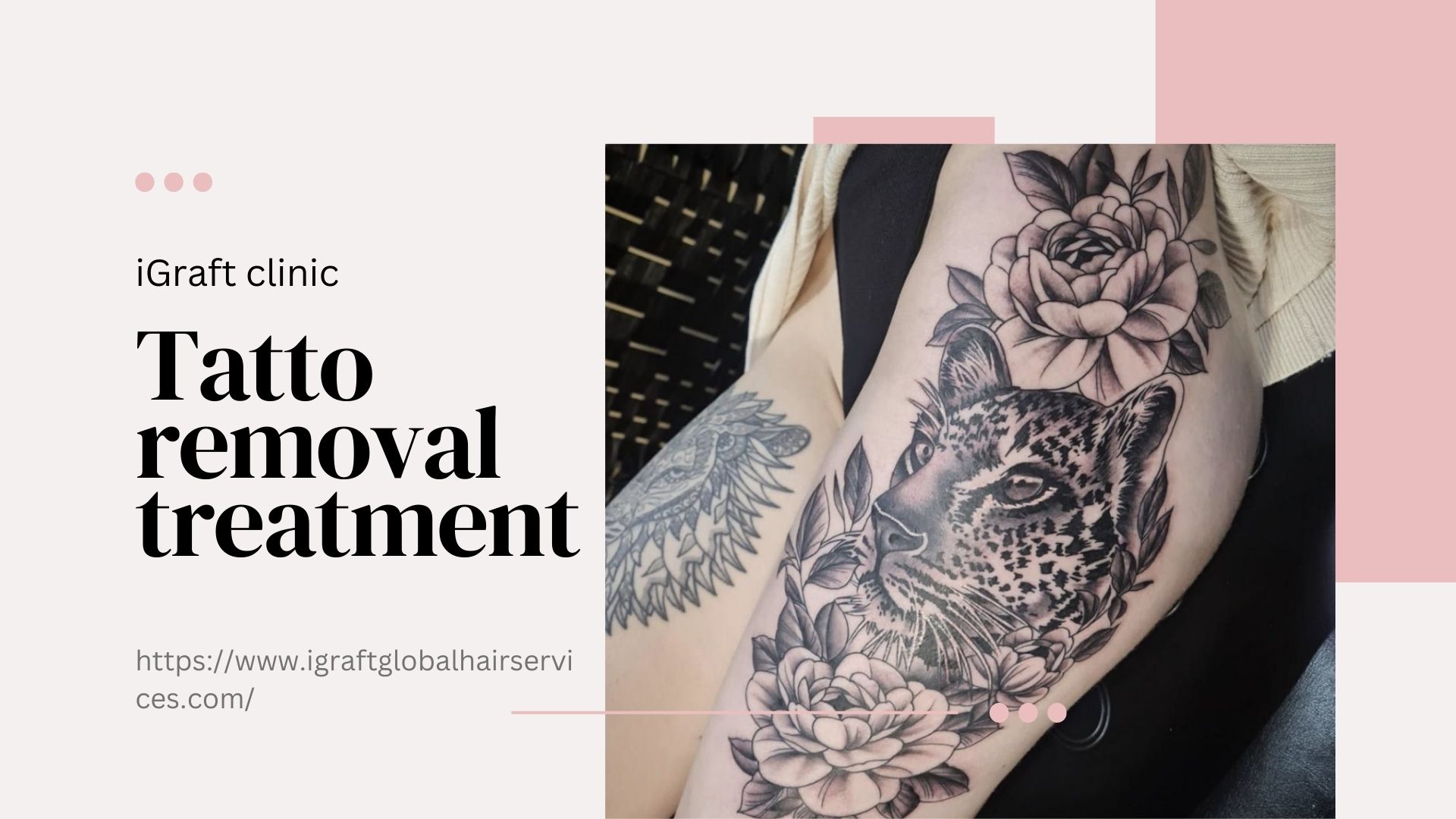 Tattoo Removal Treatment In Chandigarh | Tattoo removal in chandigarh
