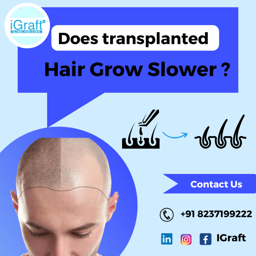 does transplanted hair grow slower