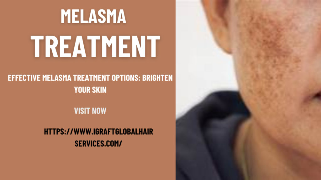 Melasma Treatment