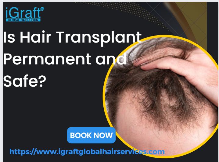 Is Hair Transplant Permanent and Safe?