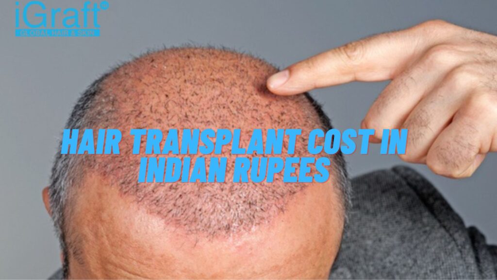 Hair Transplant Cost in Indian Rupees