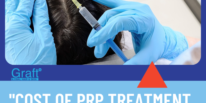 Cost of PRP Treatment in India