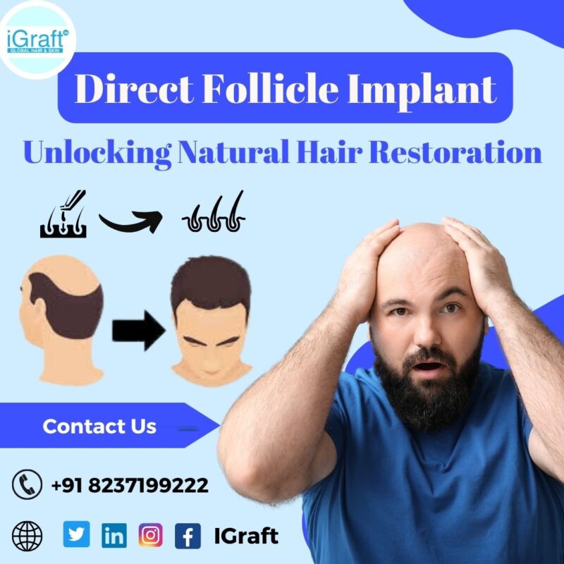 Hair Transplant|Laser Hair Reduction,Removal in India|Pune|Hyderabad ...