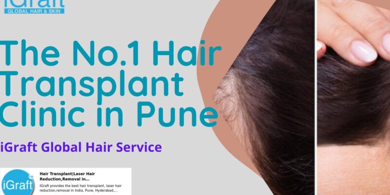 No.1 Hair Transplant Clinic Pune