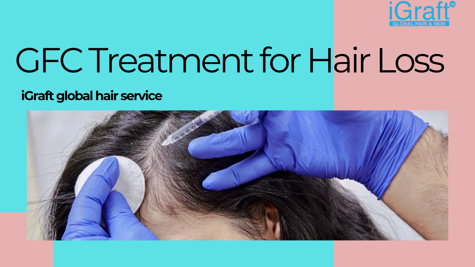 gfc-treatment-for-hair-loss