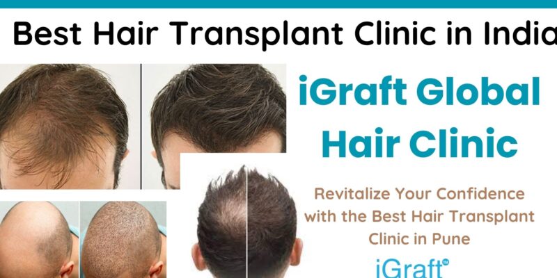 Best Hair Transplant Clinic in India -iGraft Global Hair Clinic