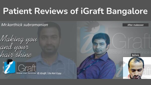 Patient Reviews of iGraft Bangalore