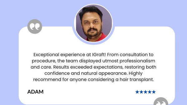 Igraft Reviews