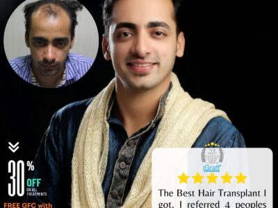 natural hair transplant results cost