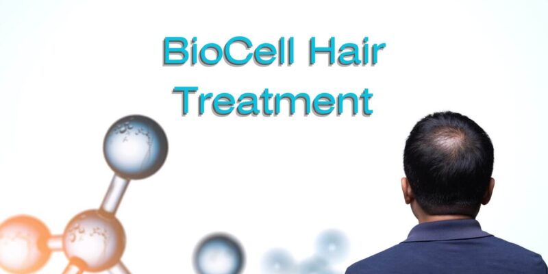 iGraft-Biocell-Hair-Treatment-near-you