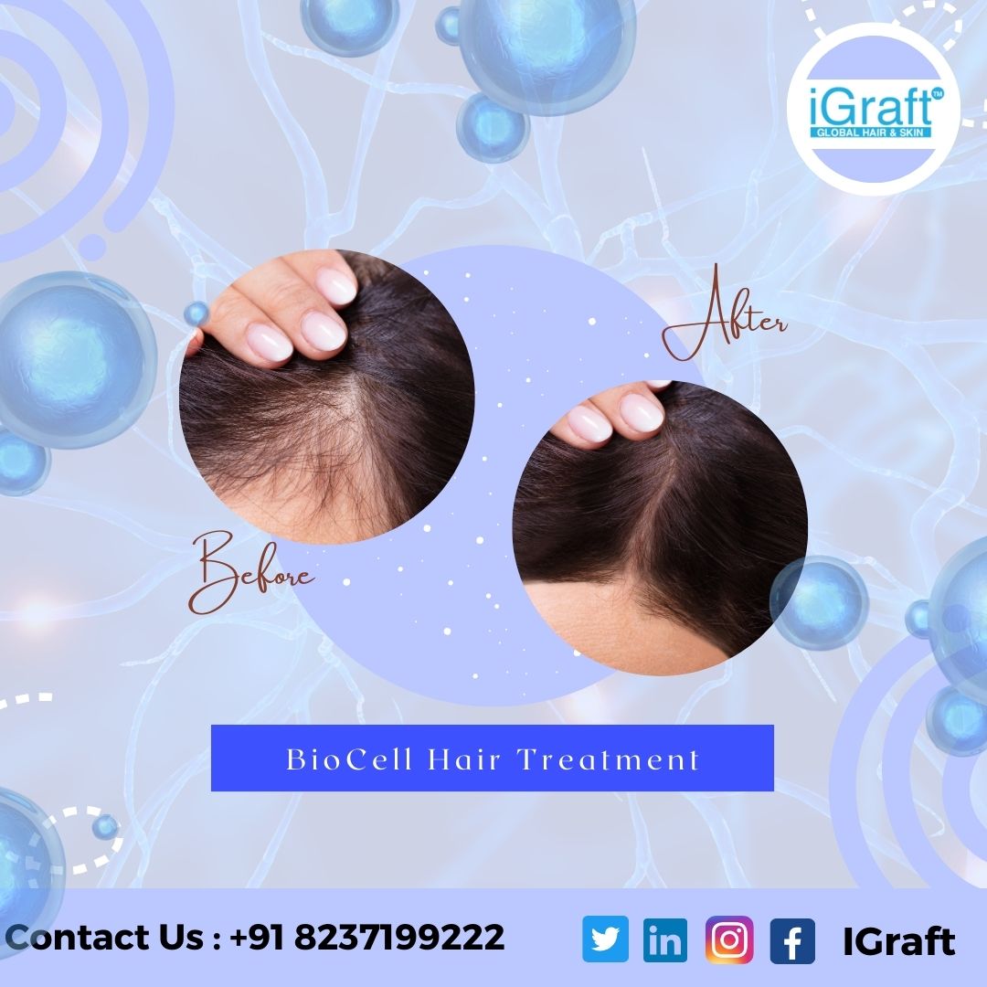 Biocell Hair Treatment