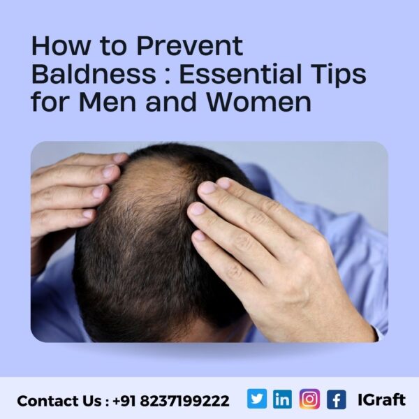 How To Prevent baldness