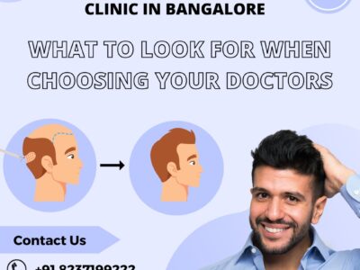 Hair Transplant Clinic