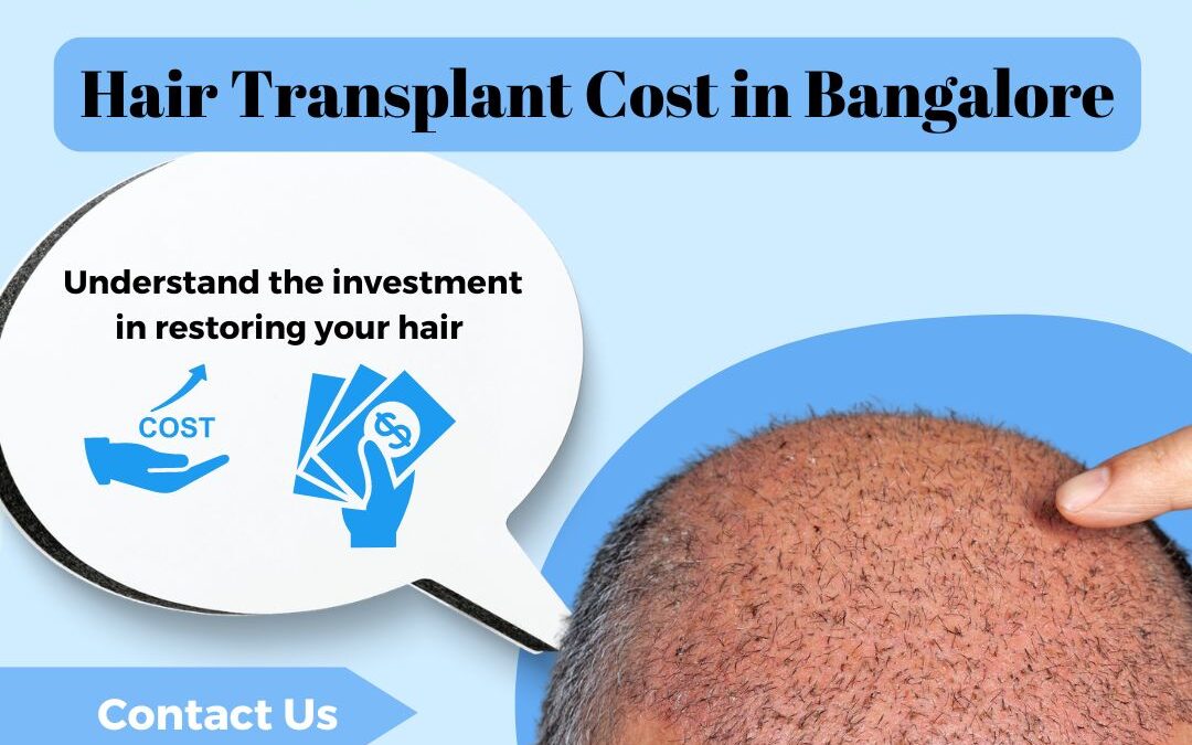 Hair transplant cost in banglore