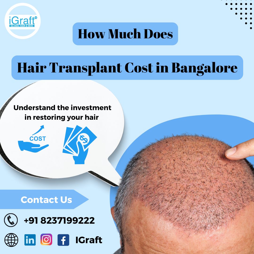 Hair transplant cost in banglore