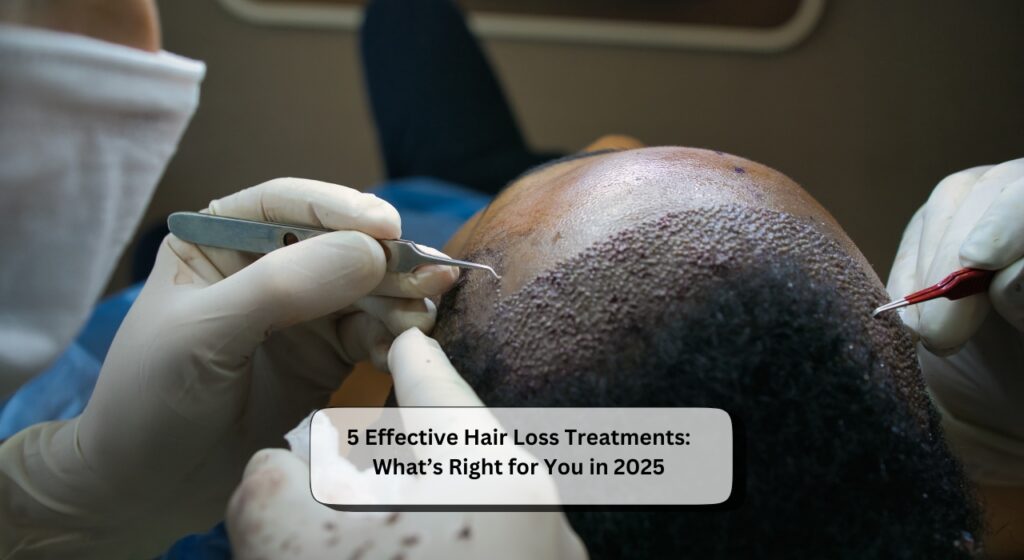 Hair Loss Treatments