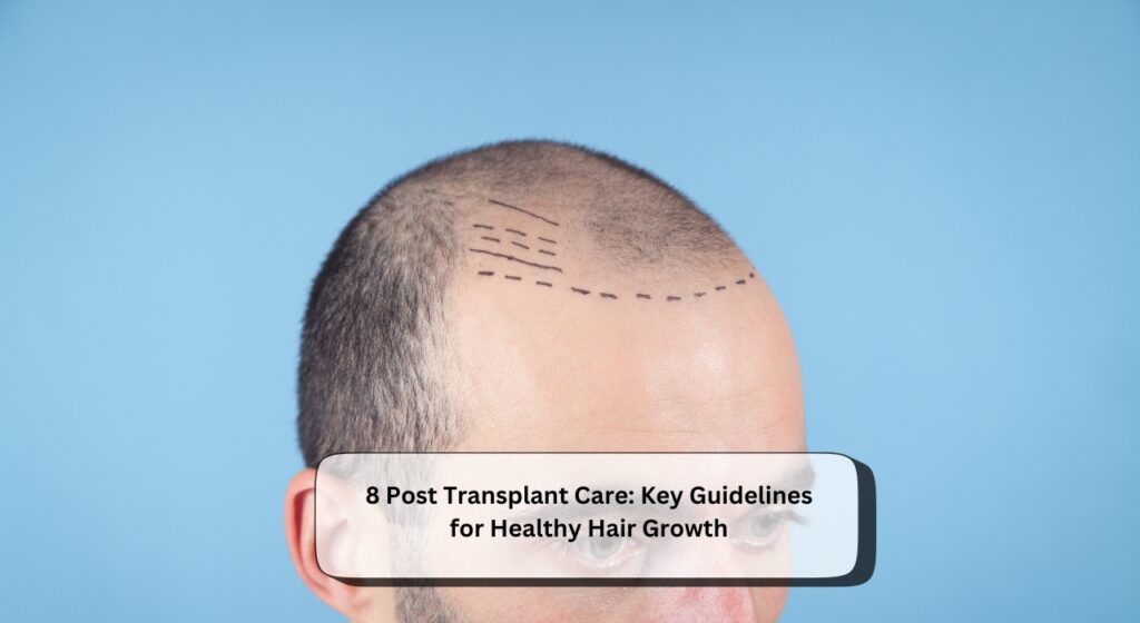 Post Transplant Care