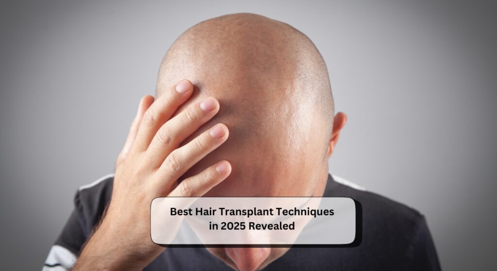 Best Hair Transplant Techniques