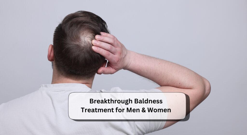 Baldness Treatment