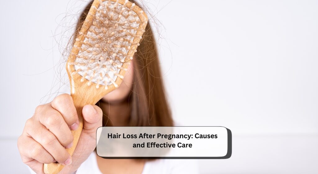 Hair Loss After Pregnancy