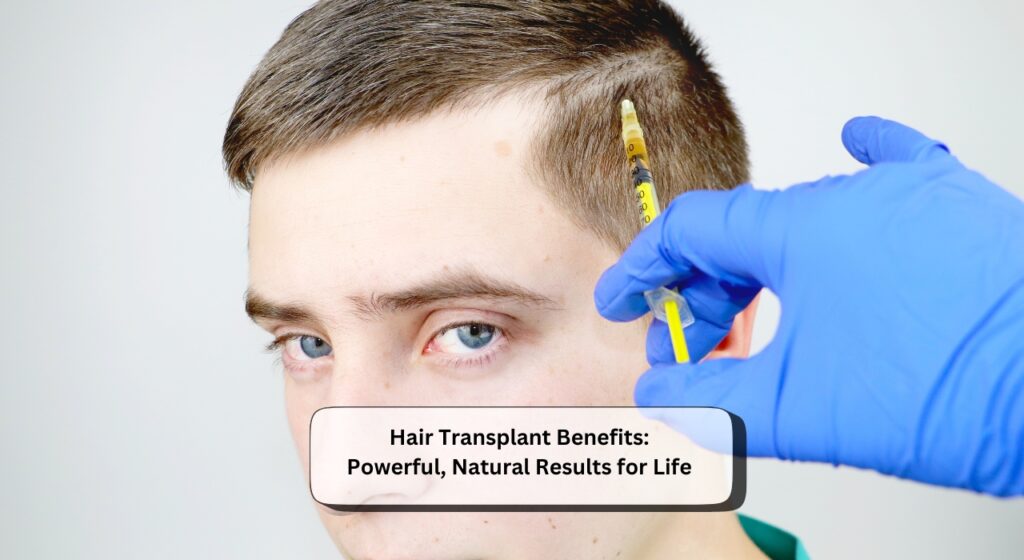 Hair Transplant Benefits