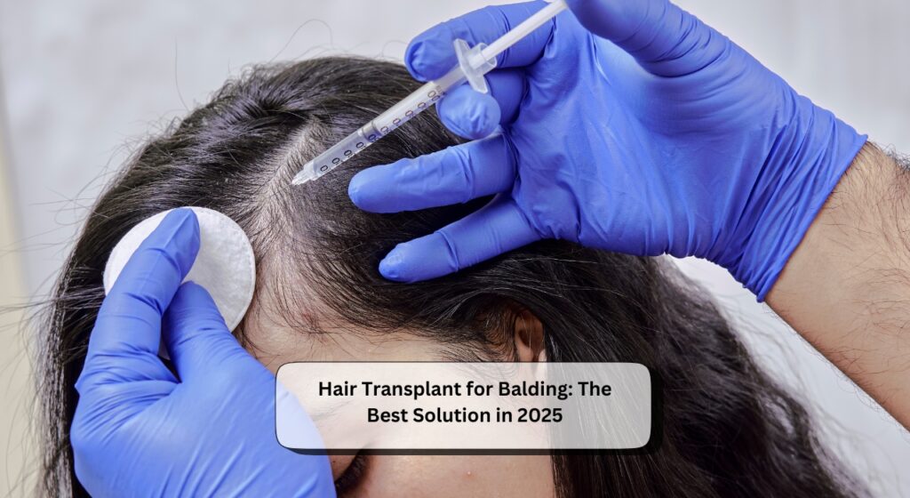Hair Transplant for Balding
