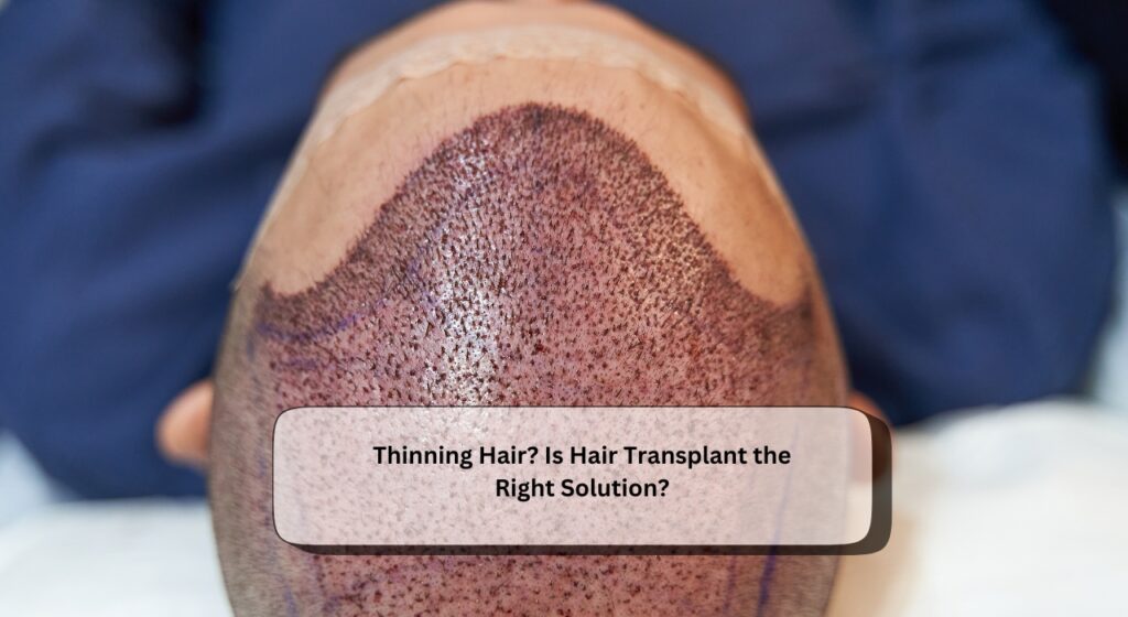 Hair Transplant