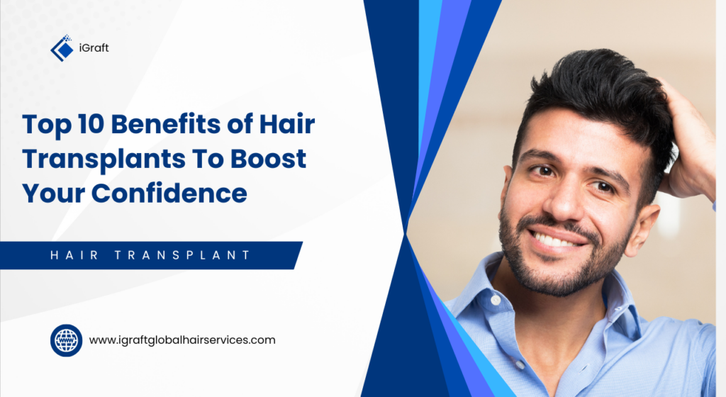Top 10 Benefits of Hair Transplants To Boost Your Confidence