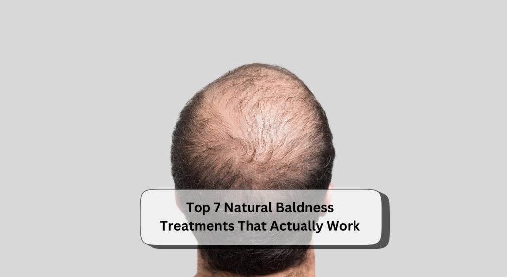 Natural Baldness Treatments