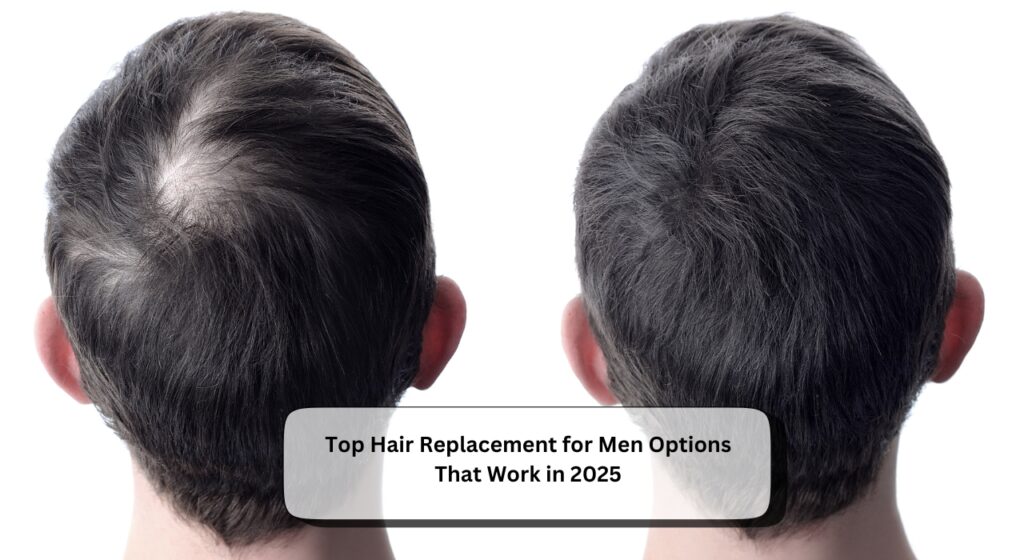 Hair Replacement for Men