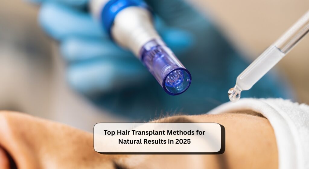 Top Hair Transplant Methods